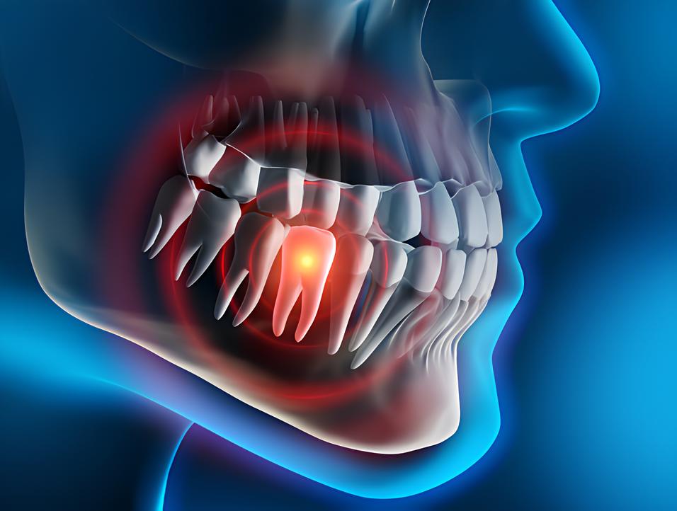 Teeth image - Emergency dentist Abbots Langley